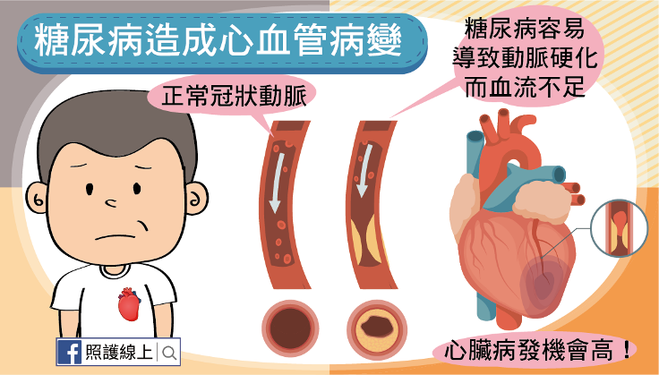 糖尿病造成心血管病變