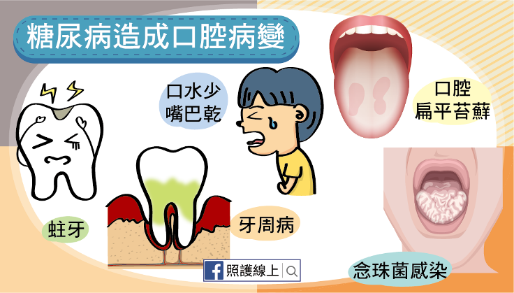 糖尿病造成口腔病變